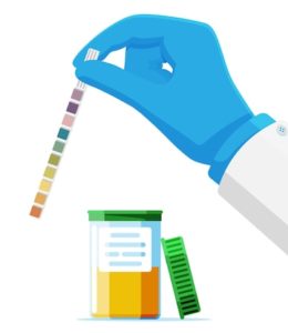 ИЗСЛЕДВАНЕ НА УРИНА / Urinalyzis